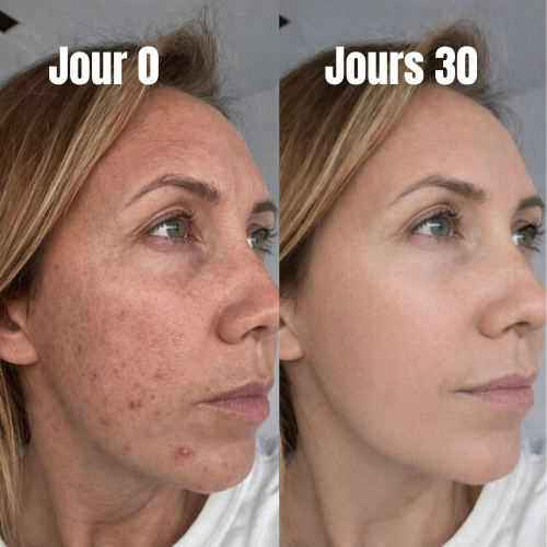 Masque Bio-Collagène - Douceur et Efficacité